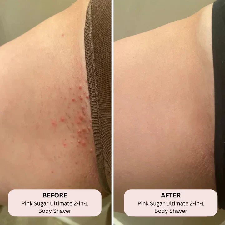 THE ULTIMATE BIKINI TRIMMER - OKMO™